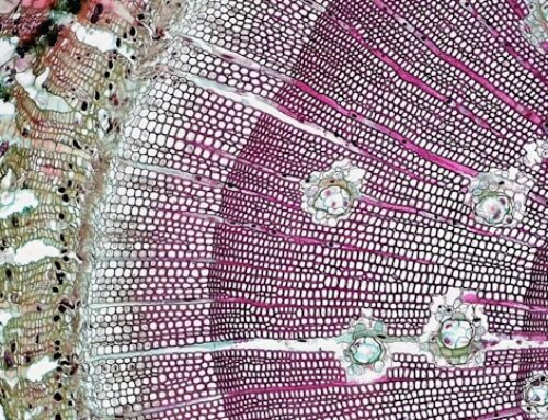 Was hat die Darmbarriere mit Histamin zu tun?